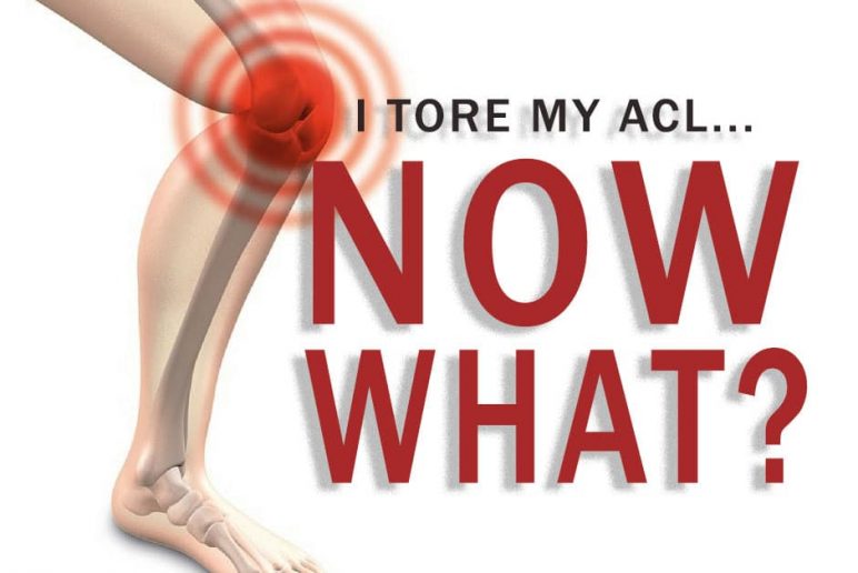 I Tore My ACL… Now What?