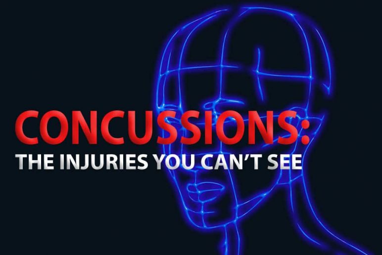 Concussions: The Injuries You Can’t See