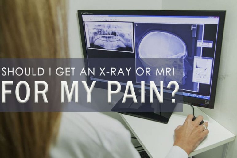 Should I Get an X-Ray or MRI for My Pain?