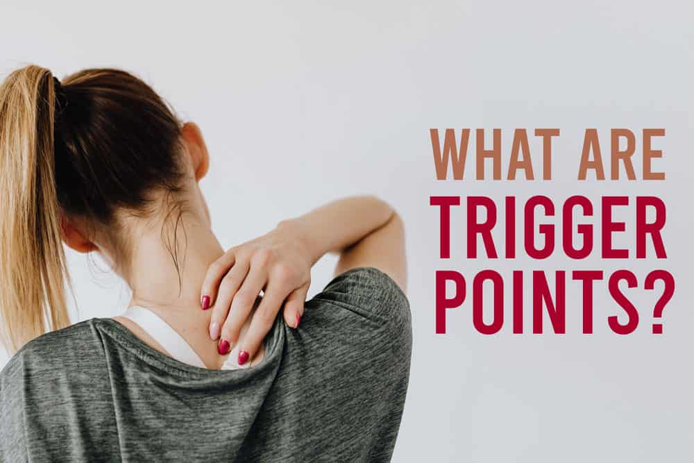 What Are Trigger Points