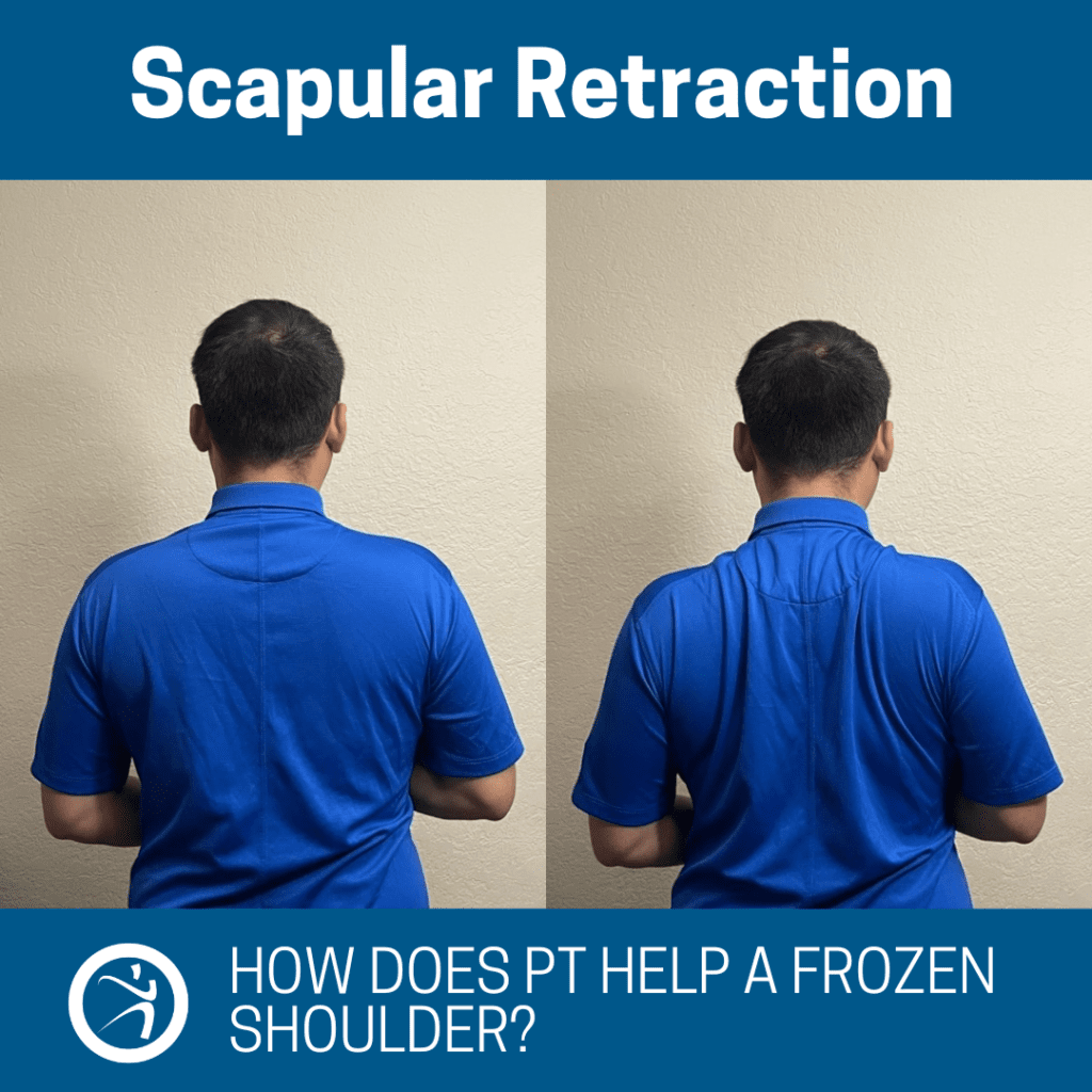 How Can PT Help a Frozen Shoulder?